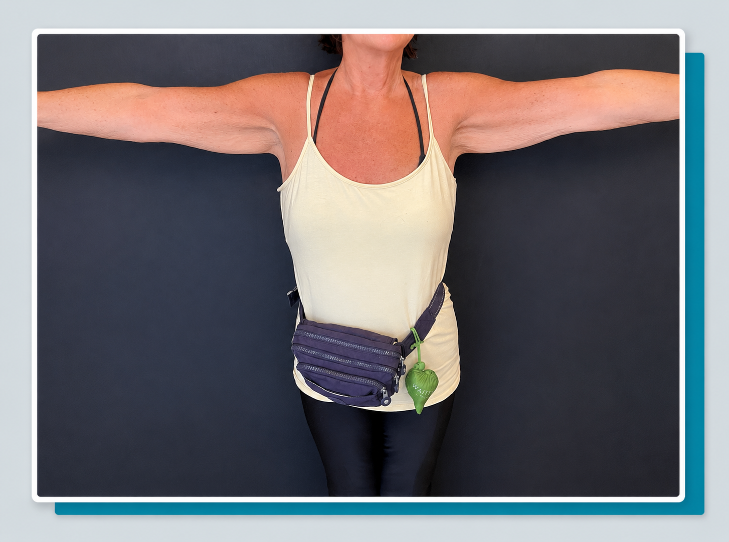 Armlift